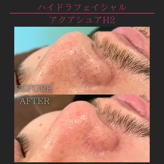 小顔、リフトアップ Lumière所属・小顔・美肌 ルミエールのエステ・リラクイメージ