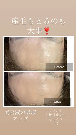 産毛専門店 Bittoのエステ・リラクイメージ