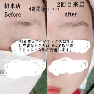 アイブロウ 脱毛サロン KiWiのエステ・リラクイメージ