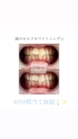 セルフホワイトニングサロンMUSE所属・セルフホワイトニング MUSE🫧焼津のその他イメージ
