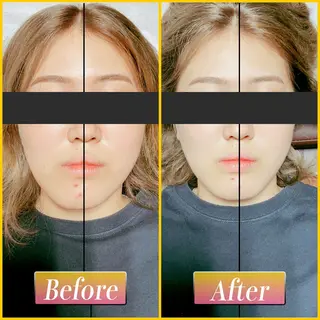 歪み専門💫筋膜整体 てんてん　畠山のエステ・リラクイメージ