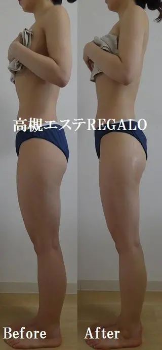 REGALO所属・矢野 さやかのエステ・リラクイメージ