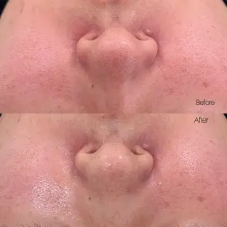 〈etre〉トータルビューティーサロン所属・etre - 韓国肌管理 -のエステ・リラクイメージ