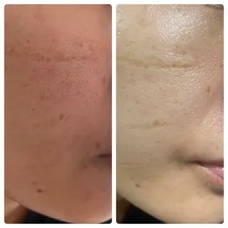 💆‍♀️松田 亜沙美のエステ・リラクイメージ