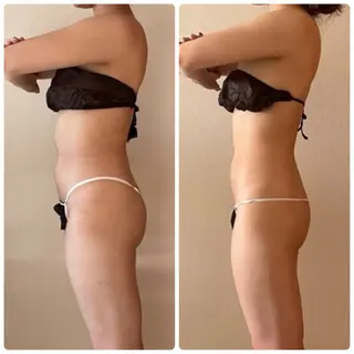 Re:Oasis所属・🦋Re:Oasis 近藤美貴【四谷】🦋のエステ・リラクイメージ