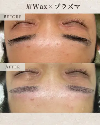 アイブロウ シミ毛穴|眉Wax THE  flowのエステ・リラクイメージ