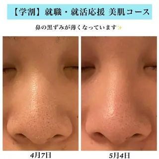 Bellesthe （ベルエステ）のエステ・リラクイメージ