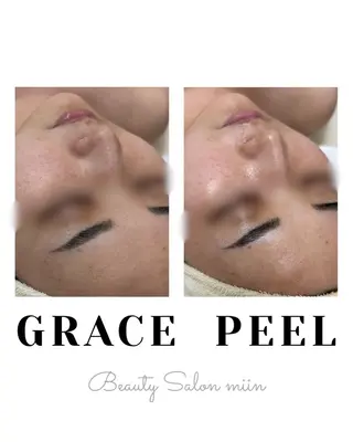 韓国肌管理 白玉肌管理®︎のエステ・リラクイメージ