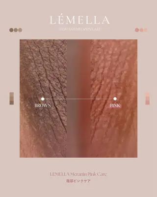 Chel チェルのその他イメージ