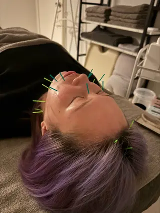 美容鍼×小顔矯正 ×美容整体　浜川泰仁のエステ・リラクイメージ