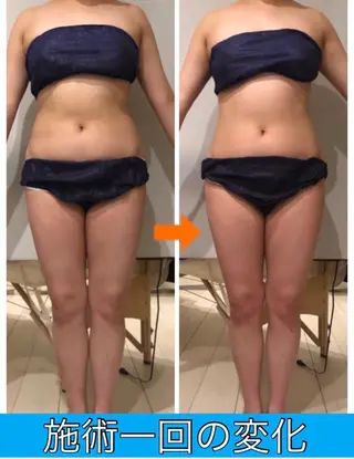 ロング カラー パーマ ヘアアレンジ メンズ キッズ ネイル マツエク・マツパ ‍痩身＆ボディ 結果出し🌟丹野のエステ・リラクイメージ