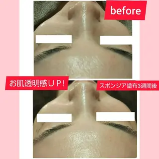 小顔と美肌 まごころエステMatoria所属・小顔 美肌専門 Matoriaのエステ・リラクイメージ