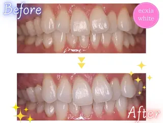 エクシアホワイト エミフルMASAKIのその他イメージ