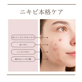 ニキビ跡専門サロン Ａｉｎａのエステ・リラクイメージ