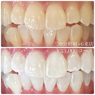 メンズ ホワイトニングルーム　川崎店所属・ホワイトニング ルーム　川崎店のその他イメージ