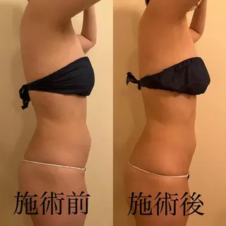 WOM SALON所属・MIKU【美容整形ダ ウンタイムケア銀座】のエステ・リラクイメージ