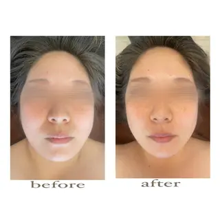 美腸専門 漢方よもぎ蒸しのエステ・リラクイメージ