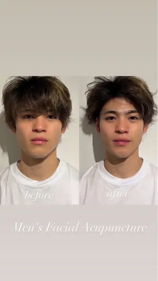 美容鍼灸サロン mahoroba院長のエステ・リラクイメージ