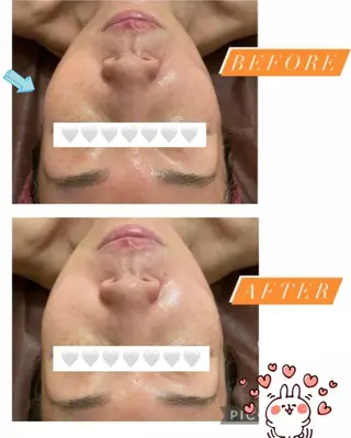 糸島 エステサロンmiuのエステ・リラクイメージ