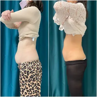 小顔矯正専門店 【RED】池田のエステ・リラクイメージ