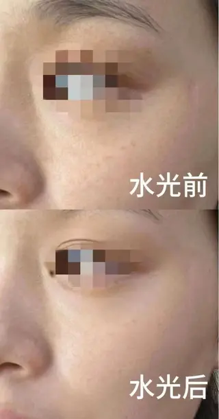 マツエク・マツパ aliaハイフ&水光ジェットサロン所属・aliaハーブ水光店 エステティシャン募集のエステ・リラクイメージ