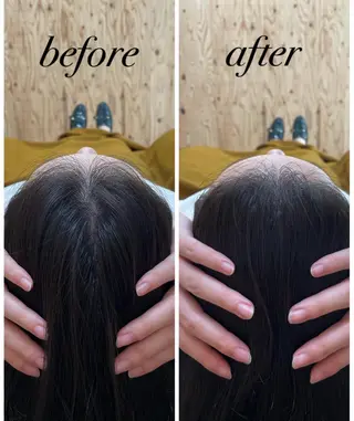 ate'所属・個室ドライヘッドスパ 🍃moriのエステ・リラクイメージ