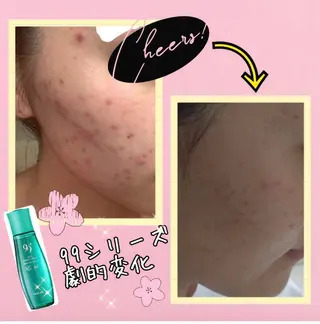 ラ.フルール　　la.fleur所属・ノエビア.ラフルール こばやしのぞみのエステ・リラクイメージ