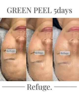 グリーンピール専門サロン Refuge.所属・Refuge. （リフュージュ）のエステ・リラクイメージ