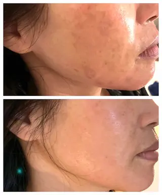 肌管理サロン neoriiのその他イメージ