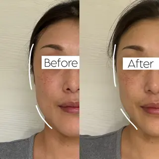 Private salon La.所属・Stellum 小顔矯正&ヘッドスパのエステ・リラクイメージ