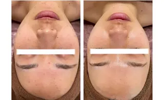 脱毛×肌管理サロン ルネルのエステ・リラクイメージ