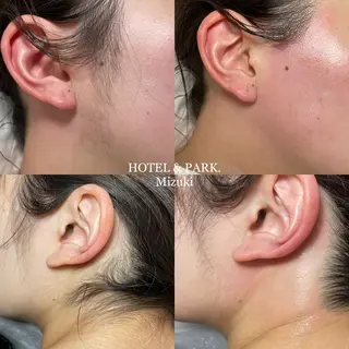 HOTEL&PARK . ワックス脱毛のエステ・リラクイメージ