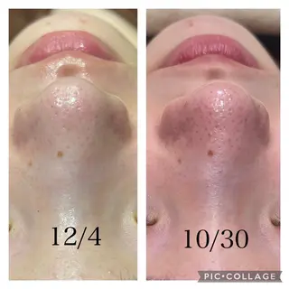 RAYVIS梅田店 HARUのエステ・リラクイメージ