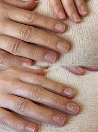ネイル Salon de A所属・【美肌専門店】 Salon de Aのエステ・リラクイメージ