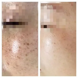 La beauté et santé岡崎店所属・望月 はるかのエステ・リラクイメージ