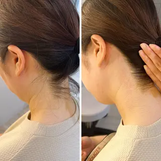 うなじ脱毛/美肌脱毛 LABELのエステ・リラクイメージ