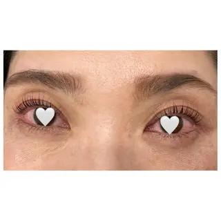 マツエク・マツパ サクラブロウ茶屋町 山矢のマツエク・マツパデザイン