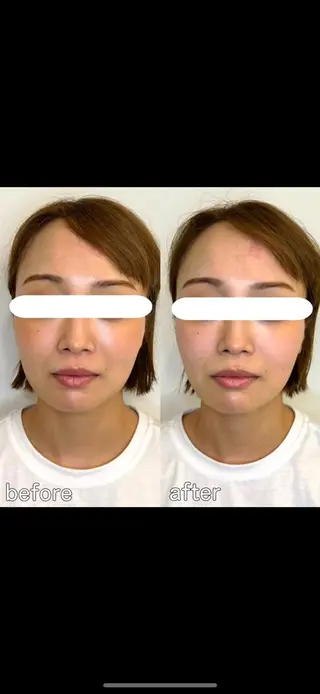 小顔矯正&美容整体 整え屋REDオーナーのエステ・リラクイメージ