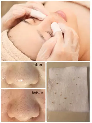 毛穴シミ改善専門 サロンド・ルパークのエステ・リラクイメージ