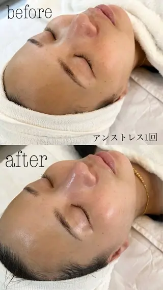 肌質改善|美眉サロンCannone'所属・肌質改善|美眉サロン Cannone’のエステ・リラクイメージ