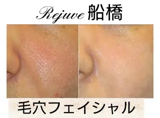 M✨ Hoshi💎✨のエステ・リラクイメージ