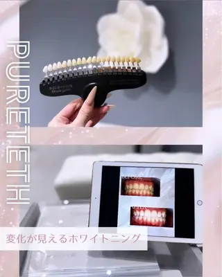 ホワイトニングサロンPURETETH所属・ホワイトニングサロン PURETETHのエステ・リラクイメージ