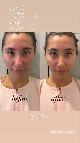 美容鍼灸サロン mahoroba院長のエステ・リラクイメージ
