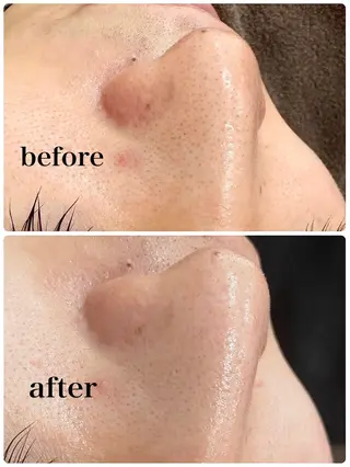 メンズ アンベリー 北浜店のエステ・リラクイメージ