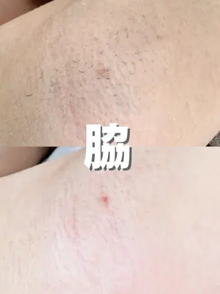 Hit. シュガーリング豊橋のエステ・リラクイメージ