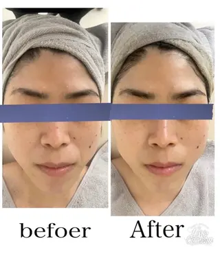 エイジングケア専門店 richbelle所属・エイジングケア専門 richbelleのエステ・リラクイメージ