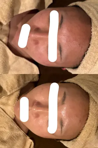 エステサロンPONO所属・PONO 天王寺／エステのエステ・リラクイメージ