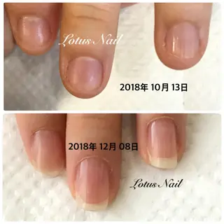 ネイル Lotus Nailのネイルデザイン