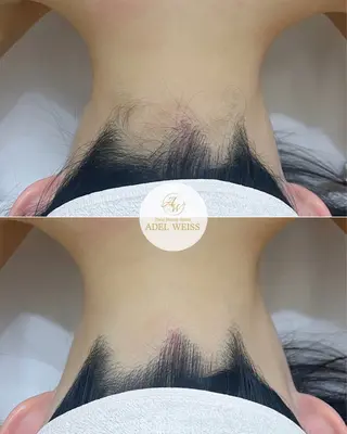 ADEL WEISS 脱毛＆毛穴＆リンパのその他イメージ