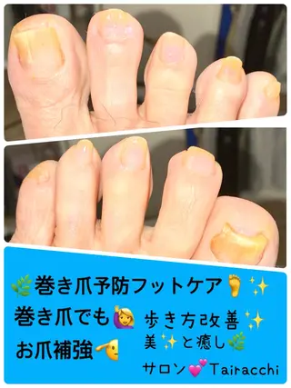 ネイル Tairacchi ﾀｲﾗｯﾁのエステ・リラクイメージ